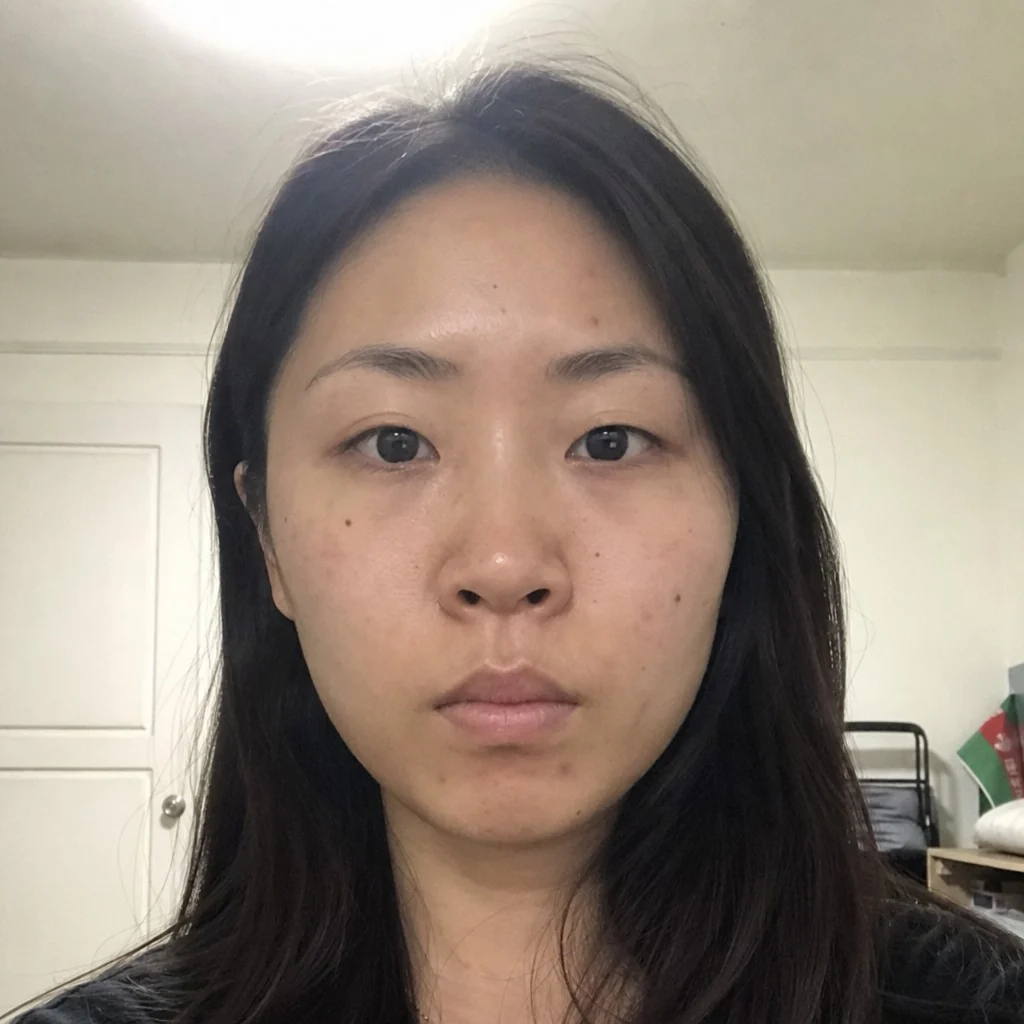 Fox Eye Lift simulation, before